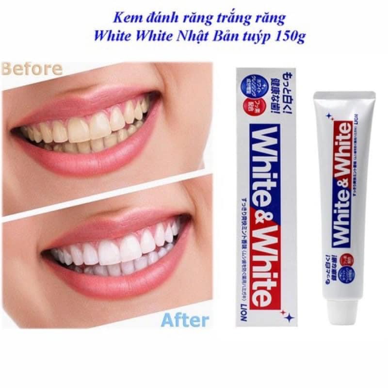 Kem Đánh Răng White And White Lion 150gr - Hàng nội địa Nhật