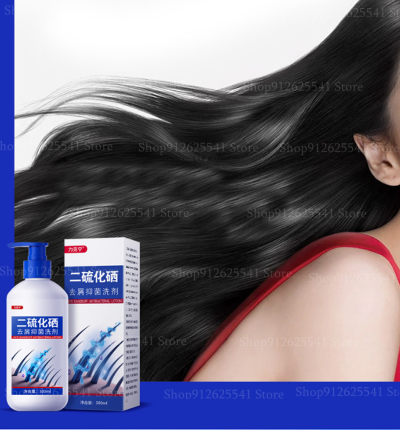 【Unbeatable Prices】 300ml Selenium Disulfide Dandruff Shampoo Anti-Dandruff Itching Anti-Hair Loss S