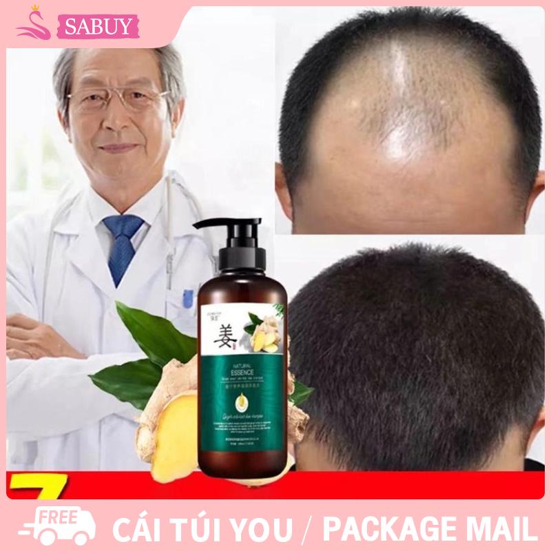 Dầu gội kích thích mọc tóc dầu gội mọc tóc giảm gãy rụng dầu gội mọc tóc nhanh kiểm soát dầu loại bỏ gàu