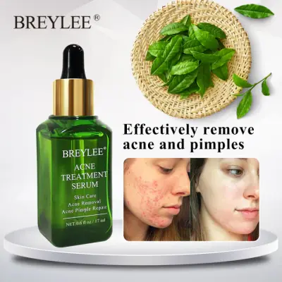 BREYLEE Acne Treatment Face Serum Anti-Acne Acne Oil Control Scar Removal Essence Facial Skin Care 17ml