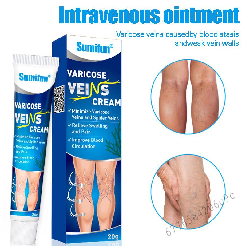 Varicose Veins Cream, Effective Varicose and Spider Veins Treatment For Strengthen Capillary Health 