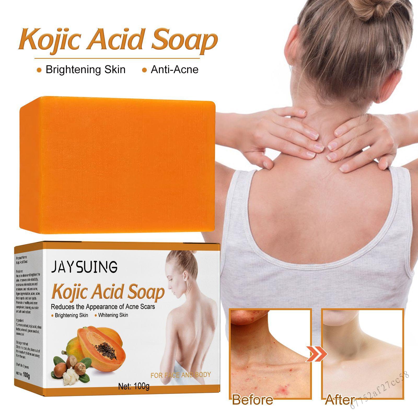 Kojic Acid Dark Spot Remover Soap Bars Natural Dark Spot Corrector Acne Scar Remover for Face & Body Acne Scars GHU-VN