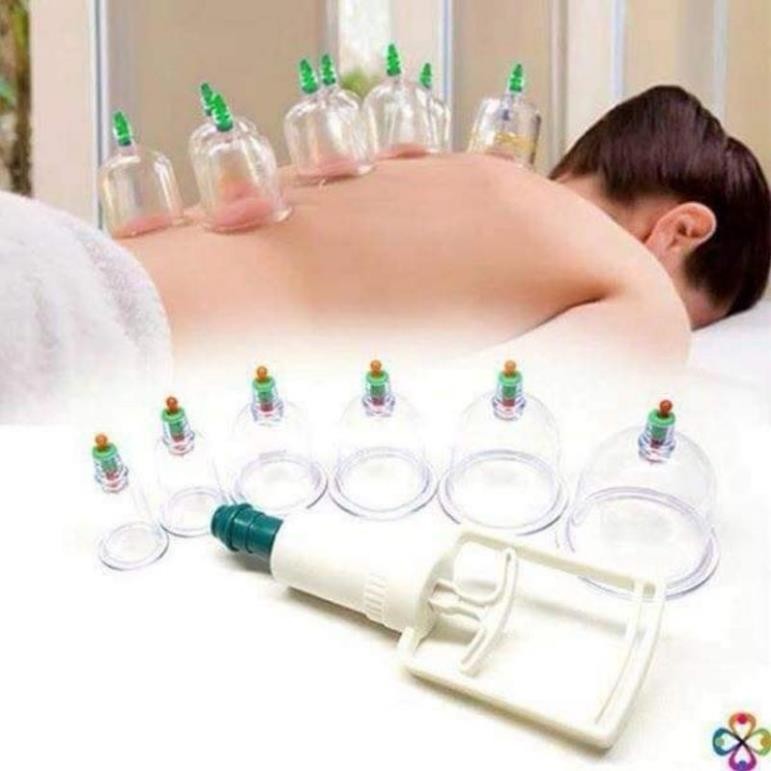 Bộ Giác Hơi 12 Món Không Dùng Lửa kèm dây nối Ống Bơm Chữa Đau Lưng Đầu Nhức Mỏi Điều Hoà Kinh Mạch