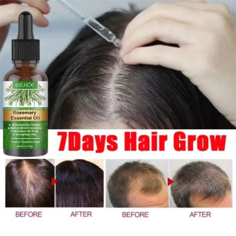 Tinh Chất Mọc Tóc EELHOE Tinh Chất Hương thảo Tươi Kích Thích Mọc Tóc, Giảm Gãy Hương thảo, Giúp Tóc Chắc Khỏe 30ml