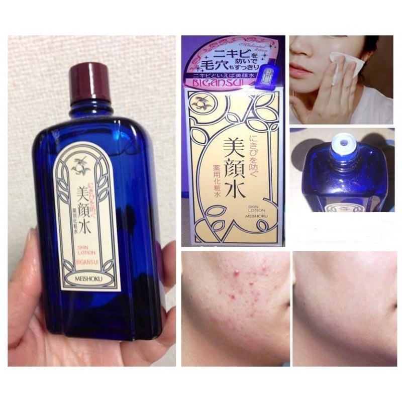 ( XẢ KHO CODE SX 23/1/2021 ) Nước Hoa Hồng Ngừa giảm Mụn Meishoku Bigansui Medicated Skin Lotion 90ml nội địa Nhật