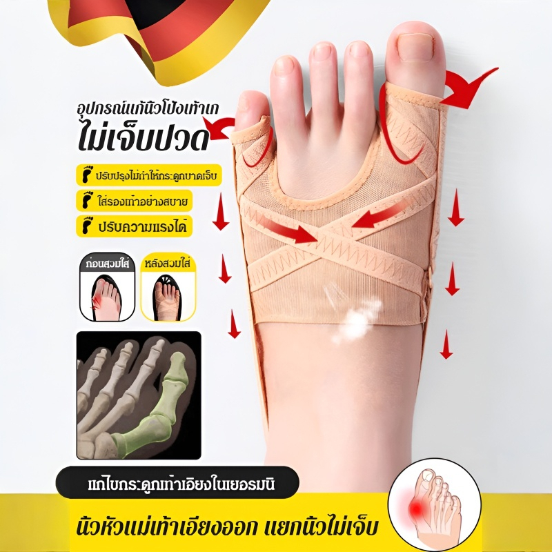 อุปกรณ์แก้นิ้วโป้งเท้าเกผ้าตาข่าย the love ข้อเท้าเอียง นิ้วหัวแม่มือ พิเศษ สนับสนุน ภาชนะ ราคา 224 บาท*ส่งฟรี