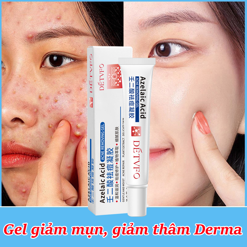 Kem chấm mụn Gel giảm mụn, chóng loại bỏ mụn bọc,giảm thâm ngăn mụn tái phát, kem bôi mụn làm mờ thâm mụn