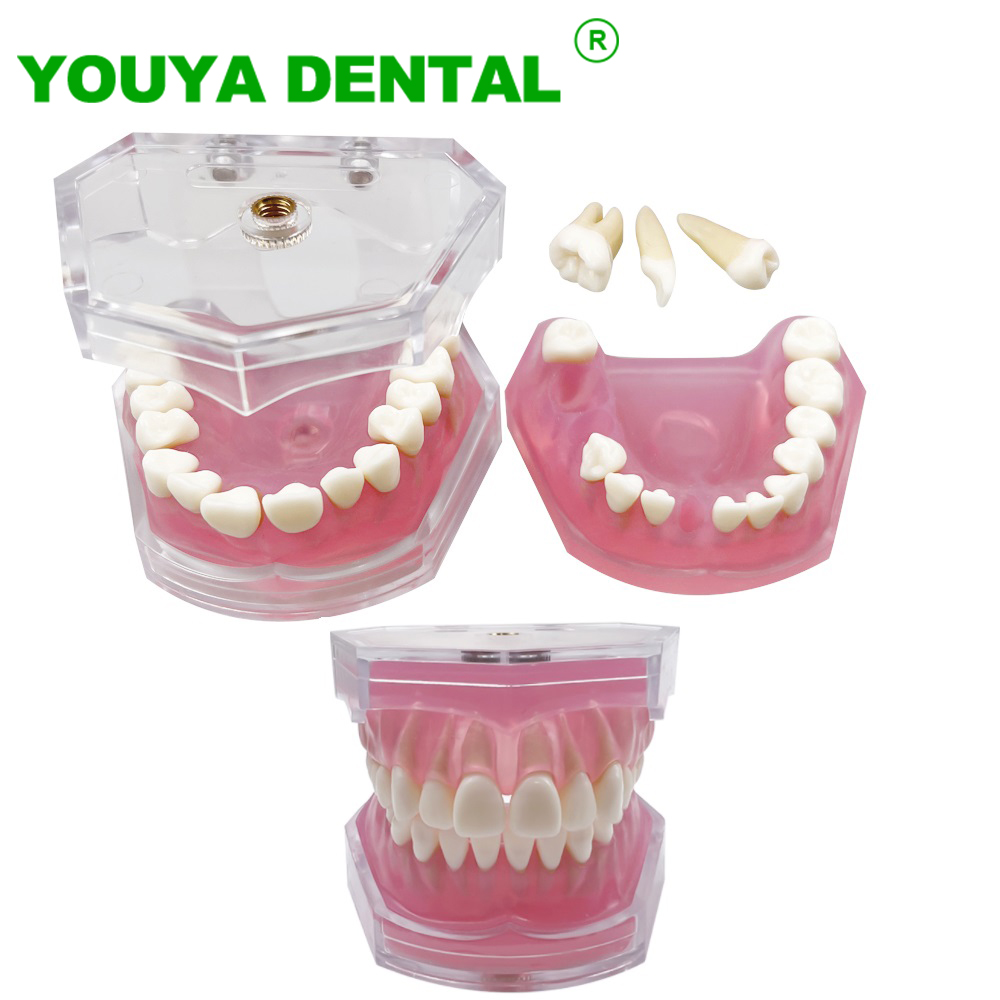 Mô hình răng nha khoa tiêu chuẩn mô hình nghiên cứu typodont với răng có thể tháo rời kẹo cao su mềm giảng dạy đào tạo trình diễn sản phẩm nha khoa
