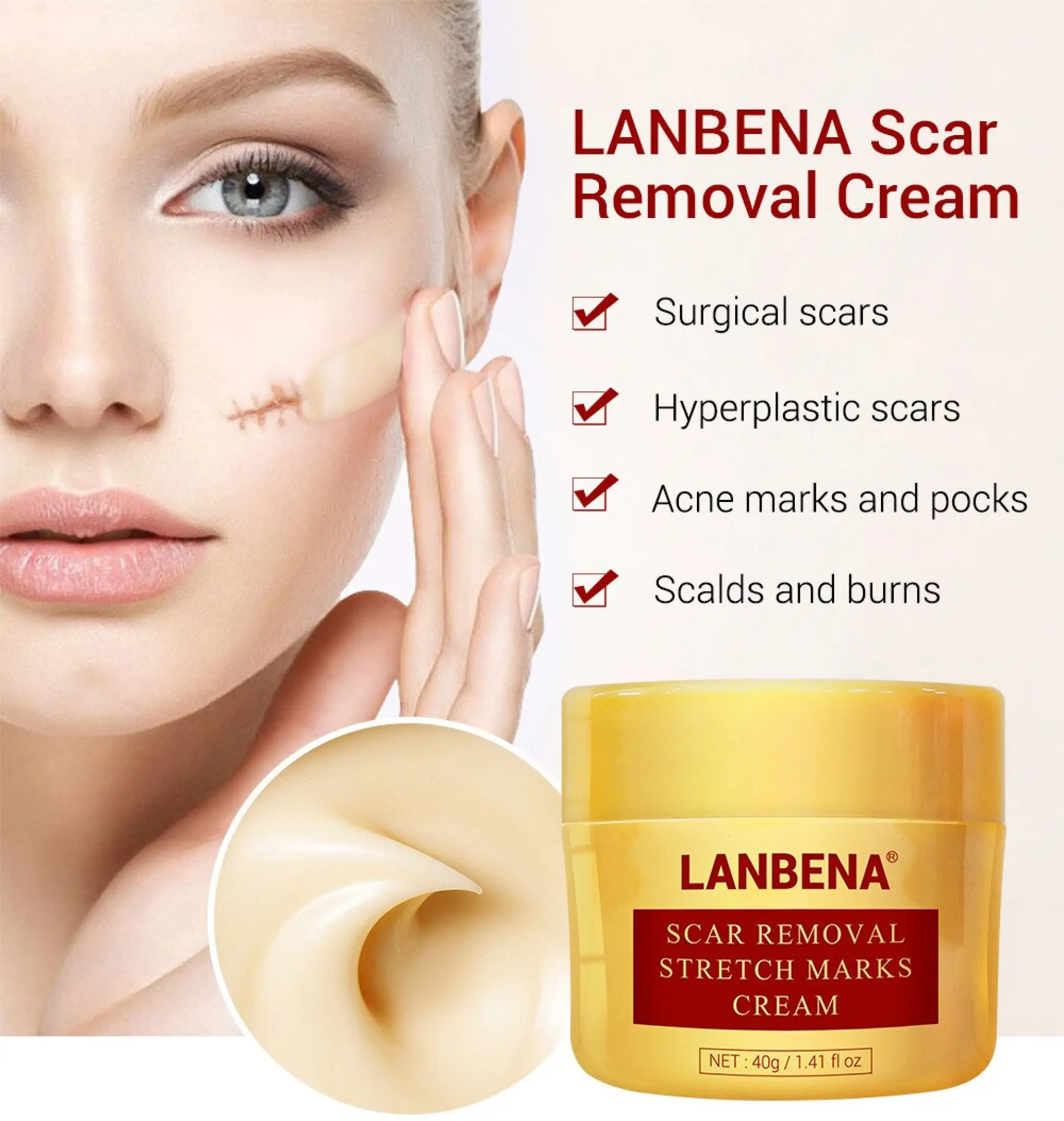 lanbena stretch mark removal