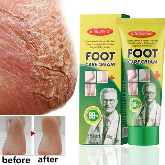 Kem nứt gót chân kem bôi nứt gót chân Kem Dưỡng Ẩm Chống Nứt Nẻ Gót Chân 100g Chống Nẻ Da