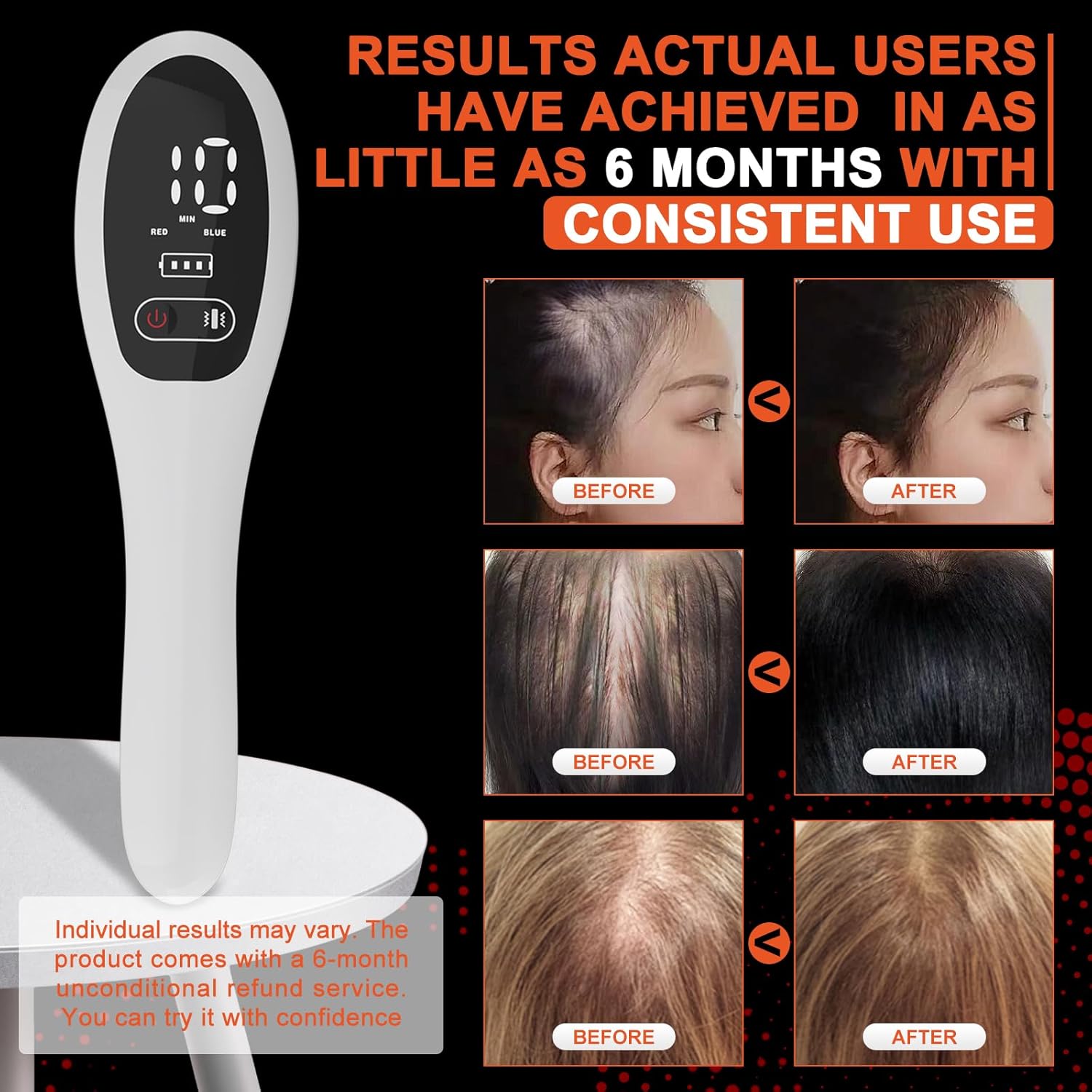 iKeener Laser Hair Growth Comb (FDA Cleared), Professional Medical Grade Lasers, Red Light Hair Growth Treatment for Men & Women, Electric Scalp Massager for Hair Growth, Treat Alopecia ราคา 2,999 บาท*ส่งฟรี