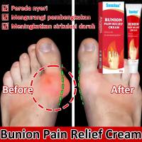 Obat Rematik Bunion Pain Salep Cream Krim Crem  Bunion Pain Relief Cream Original Salep Obat Nyeri Otot Sendi Tulang Lutut Kaki Pegal Dan Linu Pengobatan Pereda Nyeri Pada Sendi Lutut Nyeri Jari Kaki Kekakuan Perawatan Peradangan Pereda Nyeri Bunion