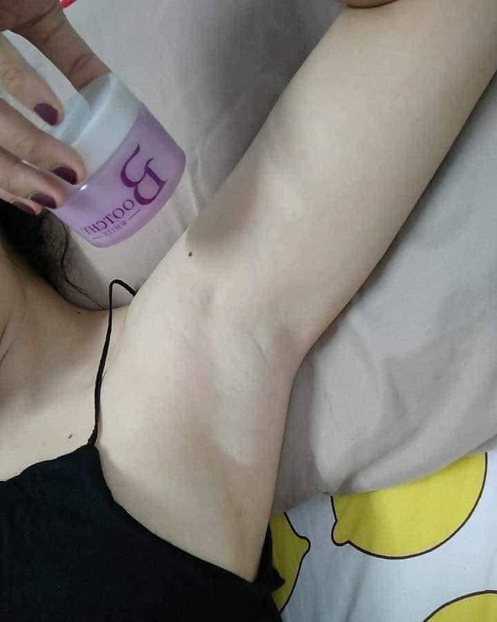 Tẩy thâm đen Bootchy White Snow Queen Extra Body Cream