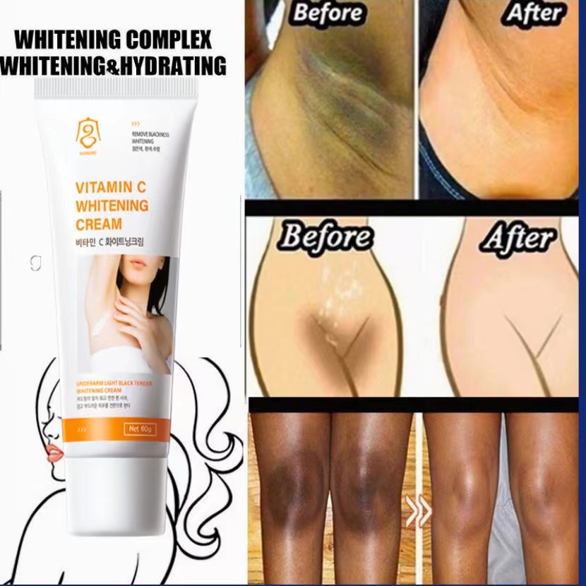  Hàn Quốc Vitamin C Kem làm trắng nách toàn thân Cải thiện làm sáng da Vết thâm Chăm sóc da 60g 