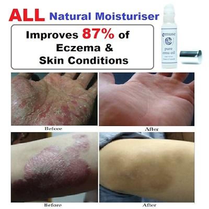 Buy Australia Emuse 100% Pure Emu Oil 100ml / HACCP and Halal Certified Singapore