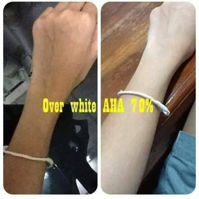 Serum kích trắng da AHA 70 X2