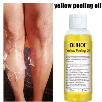 Thay Da Sinh Học | Lột Da Body Cao Cấp | Phục Hồi Tái Tạo Da|Tẩy Da Chết Hóa Học | Thay da 100ML