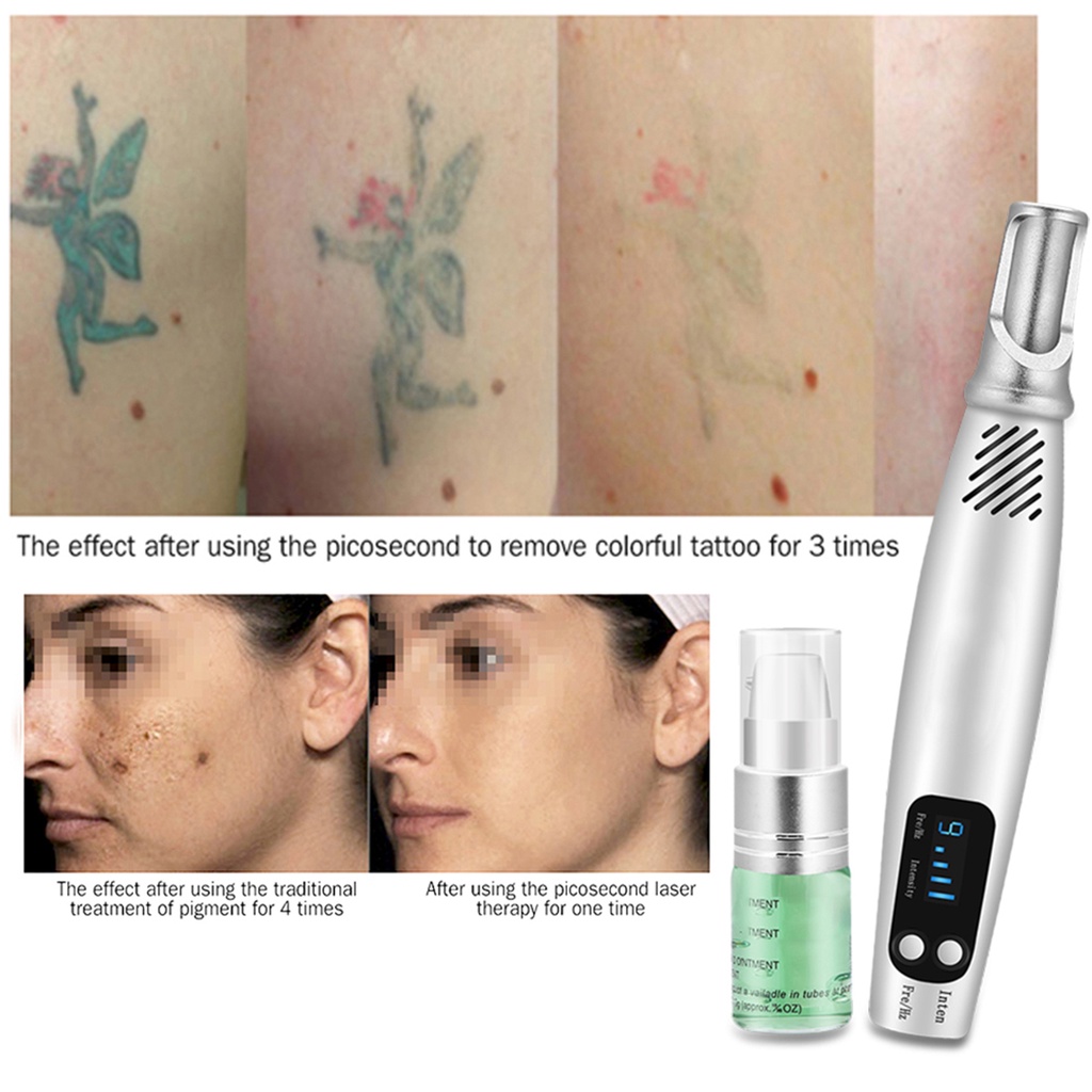 {QIQI Beauty make-up} 【Uitverkoop】Master Sculptor Moedervlek Sproet Verwijdering hine Tattoo Litteken Verwijderaar Picosecond Laser Pen_voghion.com