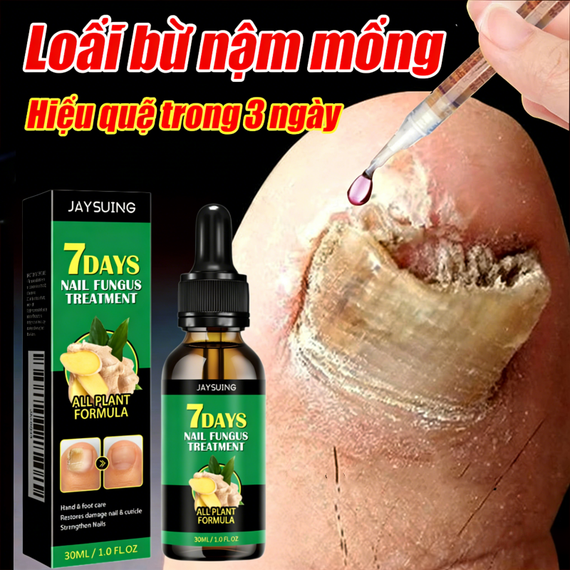 Tinh chất nấm móng, Dưỡng Móng, Phục Hồi Móng Tay Chân Loại Bỏ Nấm Móng Nhập khẩu Chính Hãng, Móng Chắc Khoẻ