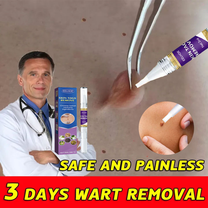  TAGS&MOLES REMOVER Gel Tẩy nốt ruồi mụn cóc ,tàn nhang ,mụn thịt  mắt cá hiệu quả 