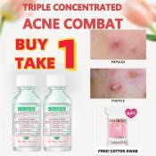 Pimple Warrior Salicylic Acid Acne Serum 30ml for Women