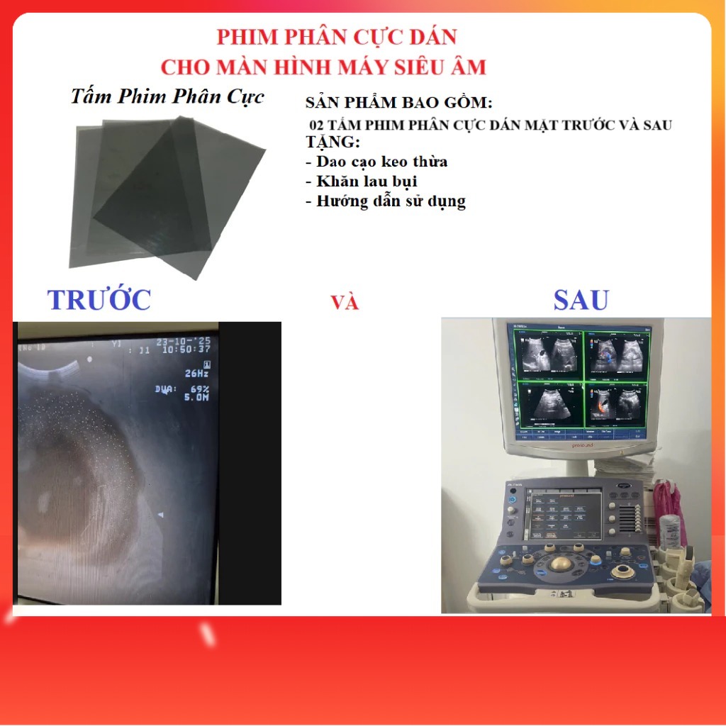 COMBO TRỌN BỘ] Phim Màn Hình Máy Siêu Âm – Máy Nội Soi + Polarizer LCD | Sửa Mờ, Sai Màu – Hiển Thị Sáng Đẹp