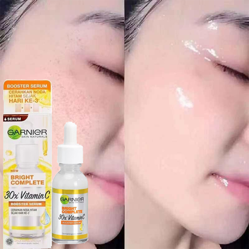 30ml vitamin C tăng cường huyết thanh Garnier sáng hoàn chỉnh nicotinamide làm sáng tông da tinh chất phai a-cne Mark Sản phẩm làm đẹp