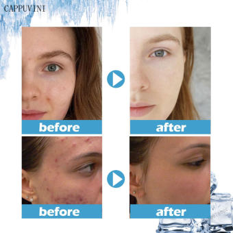 100g Hydrating Sleeping Mask Deep Gentle Hydrating Remove Acne for Most Skin Type Repairing AiOO-VN