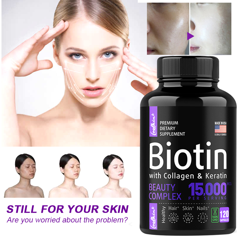 อาหารเสริมไบโอติน - วิตามินบำรุงผม คอลลาเจน โปรตีน โปรตีน คอลลาเจนcollagenแท้ ราคา 152 บาท*ส่งฟรี