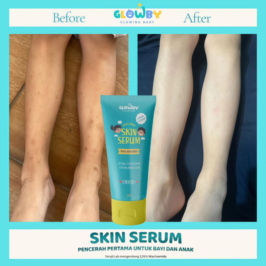 Glowby Skin Serum Pencerah Kulit Anak Dan Baby Lotion 100ml