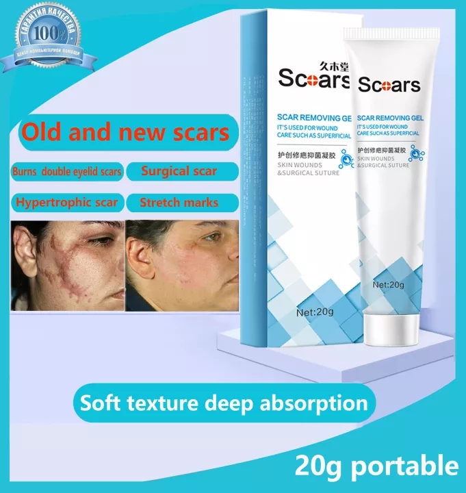 【Kem Xóa Sẹo  Che khuyết điểm sẹo, xóa sẹo lồi mãn tính, sẹo bỏng, tinh chất chiết xuất từ ​​thiên nhiên, sửa chữa bằng thảo dược,làm sáng sẹo, phục hồi da, hiệu quả nhanh chóng