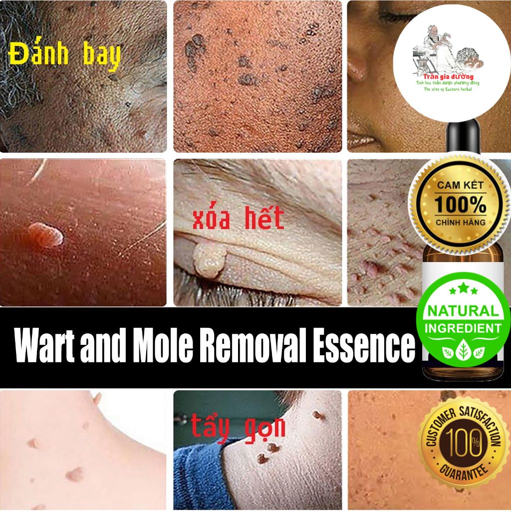 Serum eelhoe xóa nốt ruồi, mụn thịt, mụn cóc, mụn thịt thừa, thành phần thảo dượᴄ không đau rát, không để sẹo