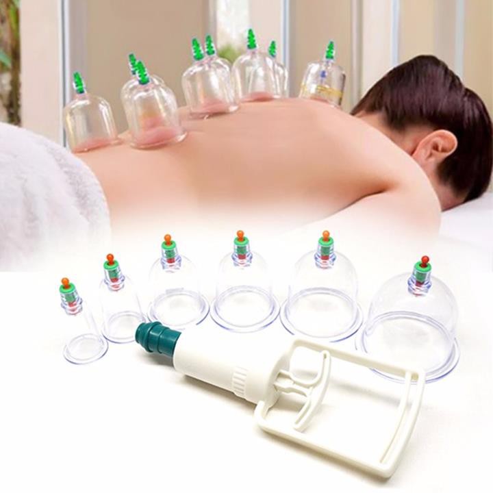 Bộ giác hơi 12 cốc nhựa - giác hơi không dùng lửa loại to
