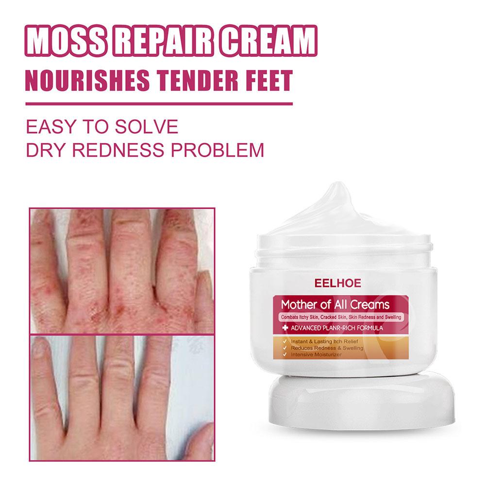Eczema Cream Anti-Itch Cream Skin Topical Skin Repair 30g Cream