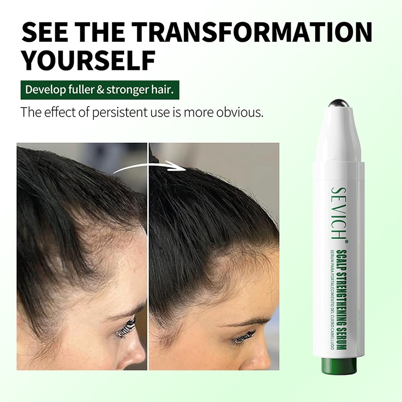 SEVICH Scalp Strengthening Serum Scalp Strengthening Roll on Serum 10ML