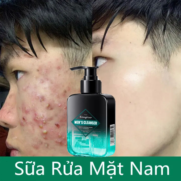 Sữa rửa mặt Nam trắng da sạch mụn 160g kiểm soát dầu và làm sạch sâu