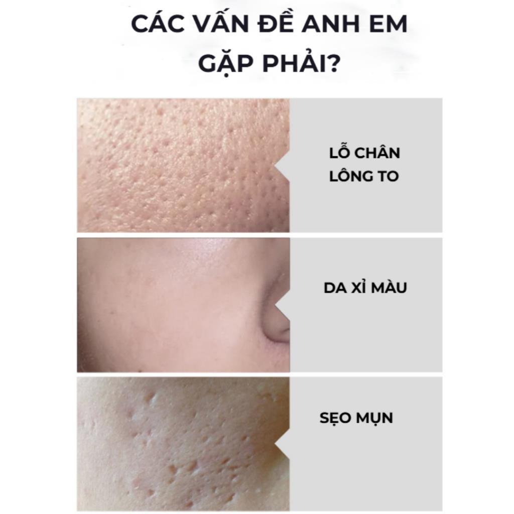 CODSữa Rửa Mặt Trắng Da BOTEXMEN –Sữa Rửa Mặt Hỗ Trợ Kiểm Soát Nhờn Giúp Sáng Da Cải Thiện Lỗ Chân Lông Cấp Ẩm Botexmen✌2025 NEW