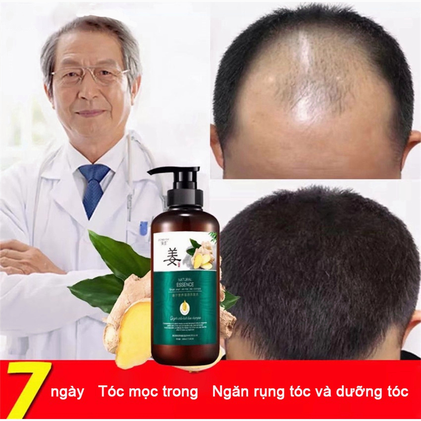 Dầu gội kích thích mọc tóc Dầu gội mọc tóc Giảm Gãy Rụng nơi rụng tóc Nhanh kiểm soát dầu loại bỏ gàu