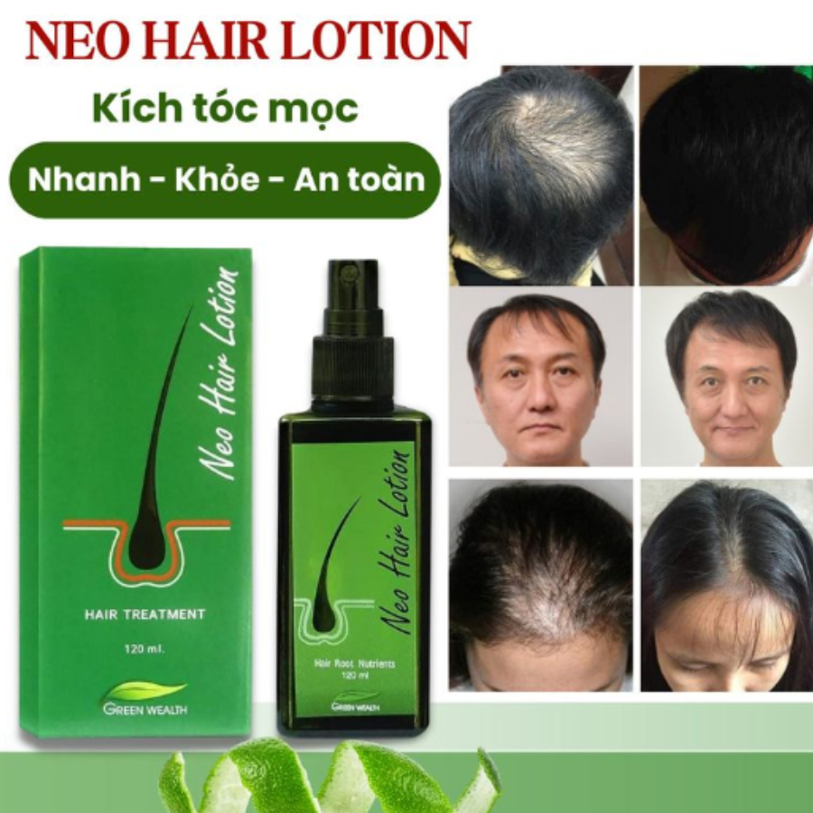 Tinh chất mọc tóc neo hair lotion kích mọc tóc nhanh - khỏe - an toàn