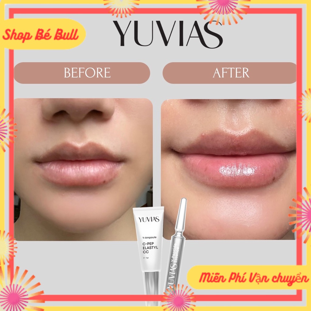   Free Ship  Kem Dưỡng Hồng Môi YUVIAS 10ml - Tặng Son Dưỡng 5ml Khử Thâm  Làm Hồng Môi  Ti 