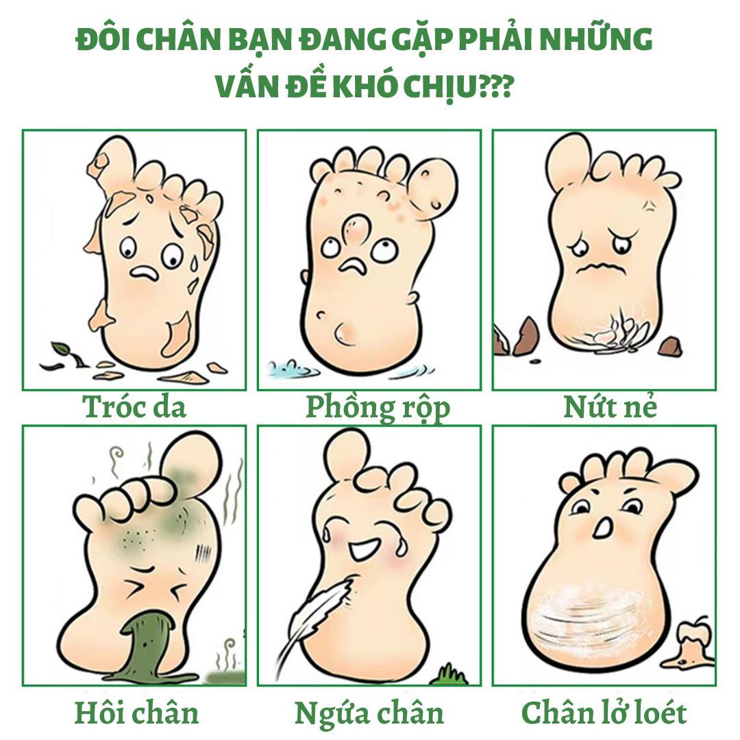 CODXịt khử mùi hôi chân kháng khuẩn da chân đánh bay nấm kẽ tróc da nứt nẻ khử mùi hôi tận gốc loại bỏ hôi chân mồ hôi chân Chống Lại Vi Khuẩn Nấm Ngưng Ra Mồ Hôi Chân Tay Ngăn M