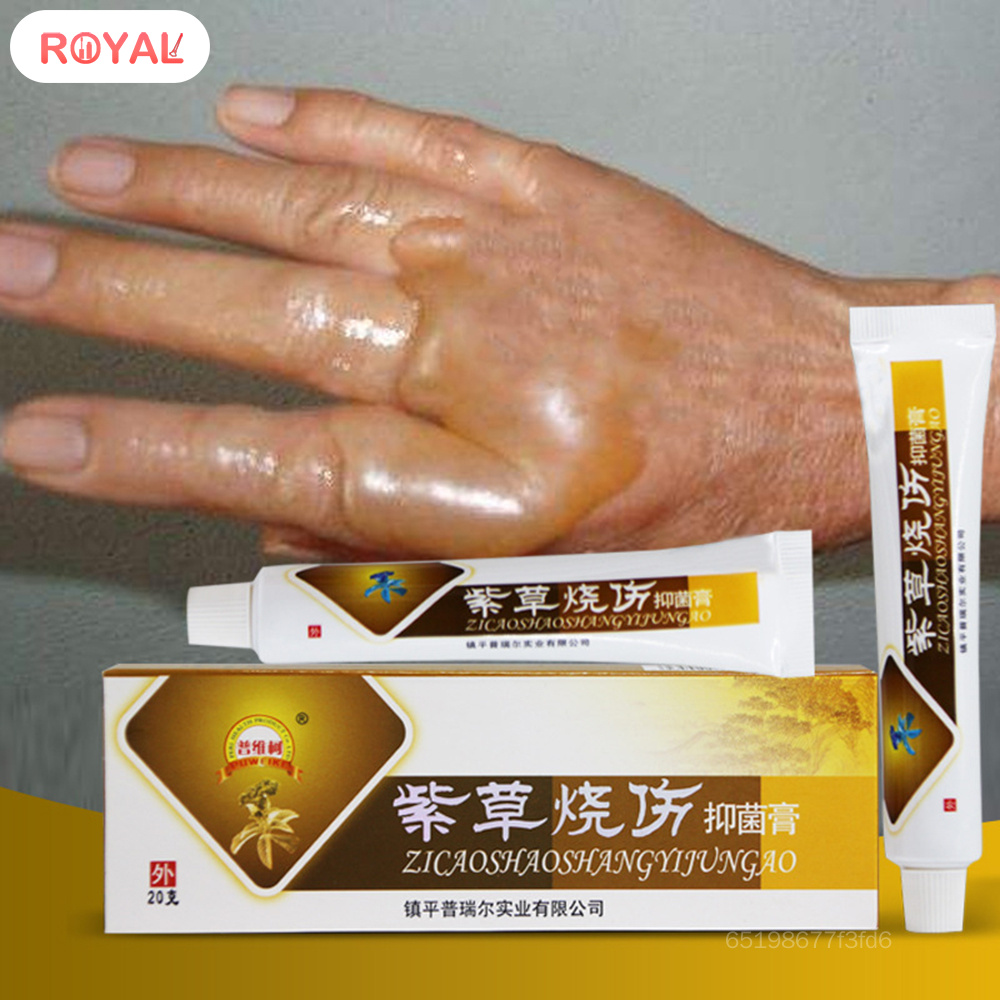 Kem điều trị bỏng kháng khuẩn hiệu quả nhanh chóng Kem bỏng khẩn cấp để sơ cứu và bỏng Relief RA-MY