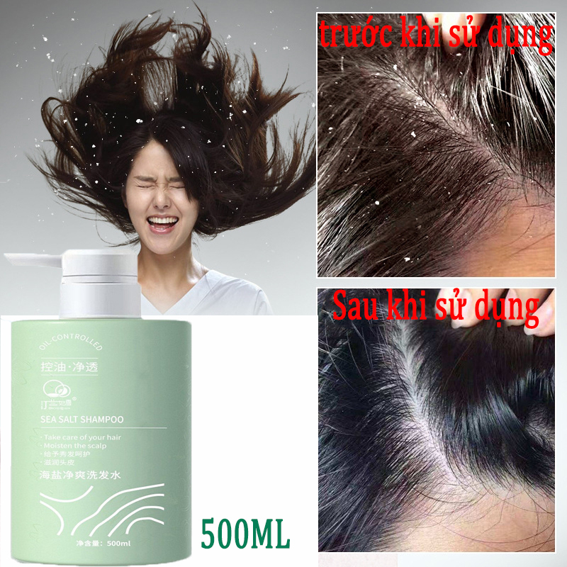 [HCM] Dầu gội đầu sạch gầu muối biển dầu gội đầu tẩy tế bào chết Dầu gội chống ngứa 500ml Làm sạch chuyên sâu da đầu Tẩy tế bào chết chống ngứa chống nấm sảng khoái kiểm soát dầu  Làm dịu mát da đầu giá rẻ