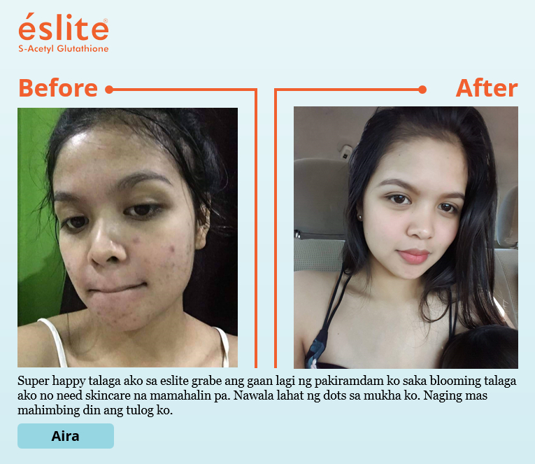 glutathione day and night cream Glutathione Day & Night Cream for Radiant Skin | Anti-Wrinkle Glow &  Softness - 50gm