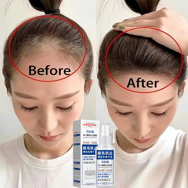 Mọc tóc tonic serum dưỡng tóc cho mọc tóc chống rụng tóc thảo dược tinh chất chăm sóc 60ml cho nam g