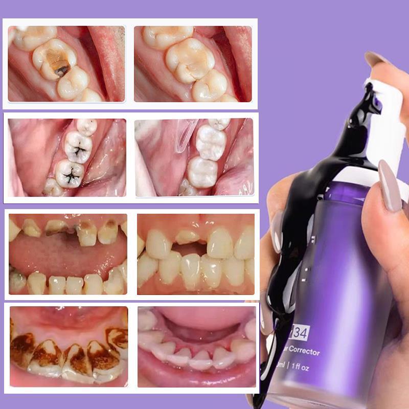 CODSerum Hissmile V34 Tinh Chất Trắng Răng Hút Ố Vàng Loại Bỏ Cao Răng Thơm Miệng Hissmile V34 2025 NEW