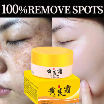 Kem nám tàn nhang kem đặc chấm tàn nhang nám tàn nhang 70g Loại bỏ các đốm đen sâu làm sáng trắng da