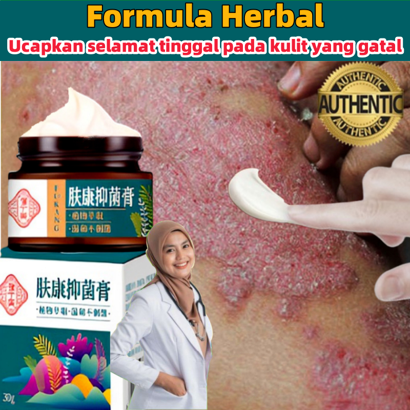 Kem bọ cạp bôi nấm ngứa, hắc lào, á sừng,vẩy nến ,Da Đầu Gói Chống tái đi kèm hàng sẵn giao nhanh