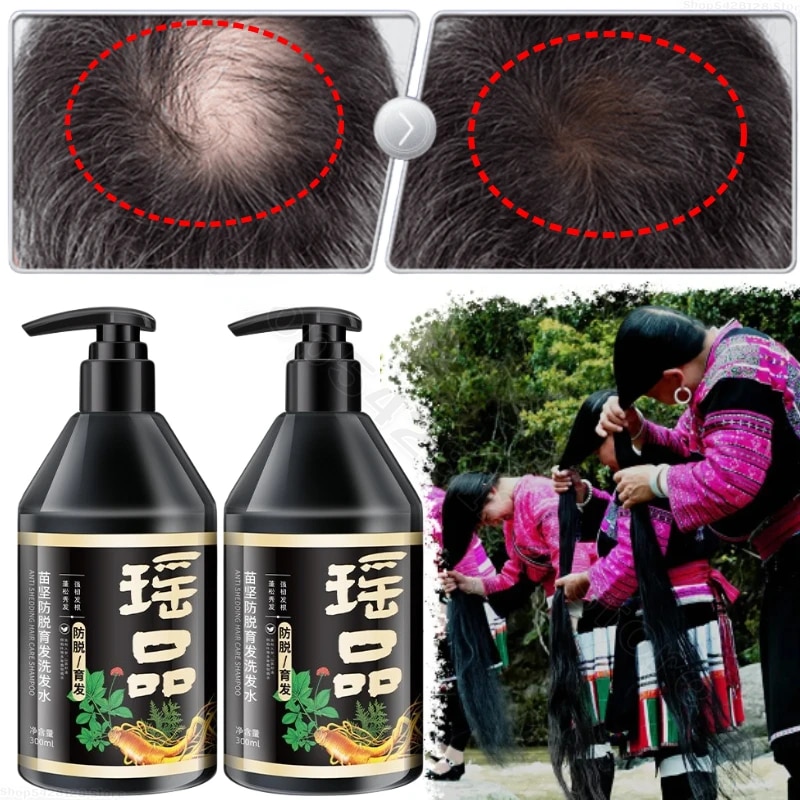 New Yao Pin Anti-Default Shampoo Dầu gội thảo dược, Cải thiện tóc trắng rụng, chống trầy xước, chống ngứa, kiểm soát dầu