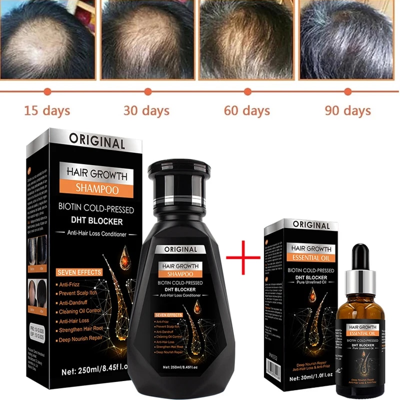 【Thriving】 Hair Growth Essential Biotin Cold-Pressed Dht Blocker And Hair Growth Shampoo Anti-Hair L